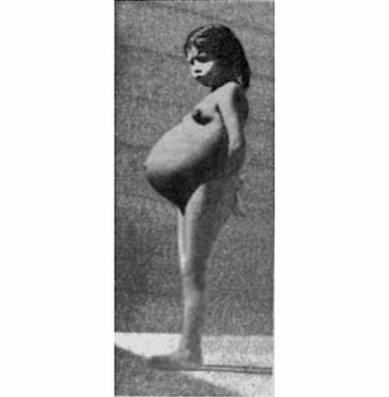 Самая молодая мама: Лина Медина Самая молодая мама: Лина Медина