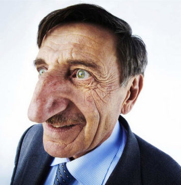 Самый длинный нос: Мехмет Озюрек